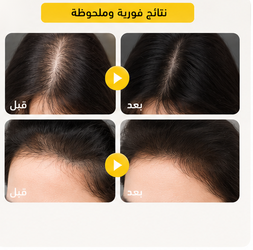 علبة ملء فراغات الشعر